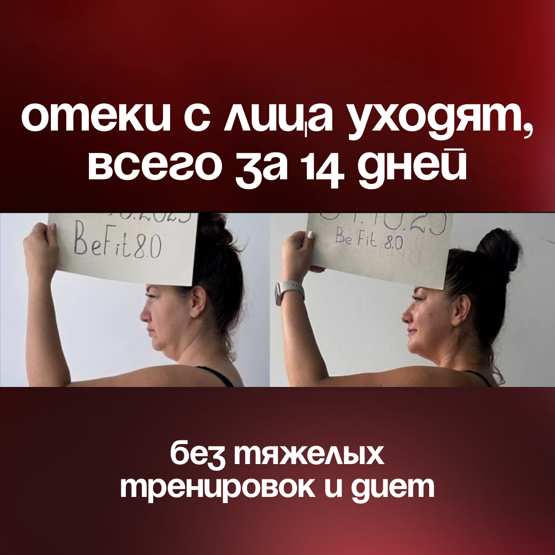 Результат участницы — отёки с лица за 14 дней